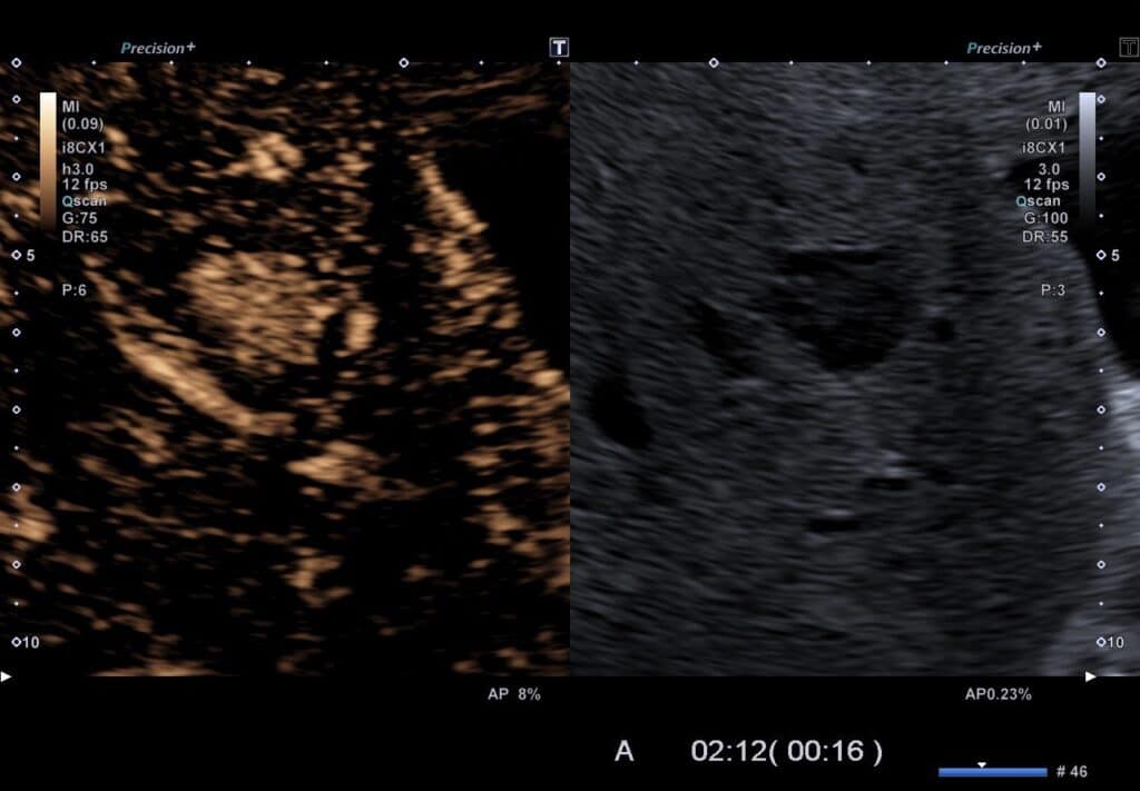 KM-Sonographie FNH