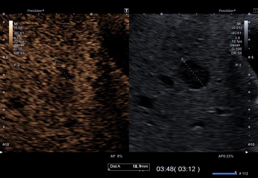 KM-Sonographie FNH