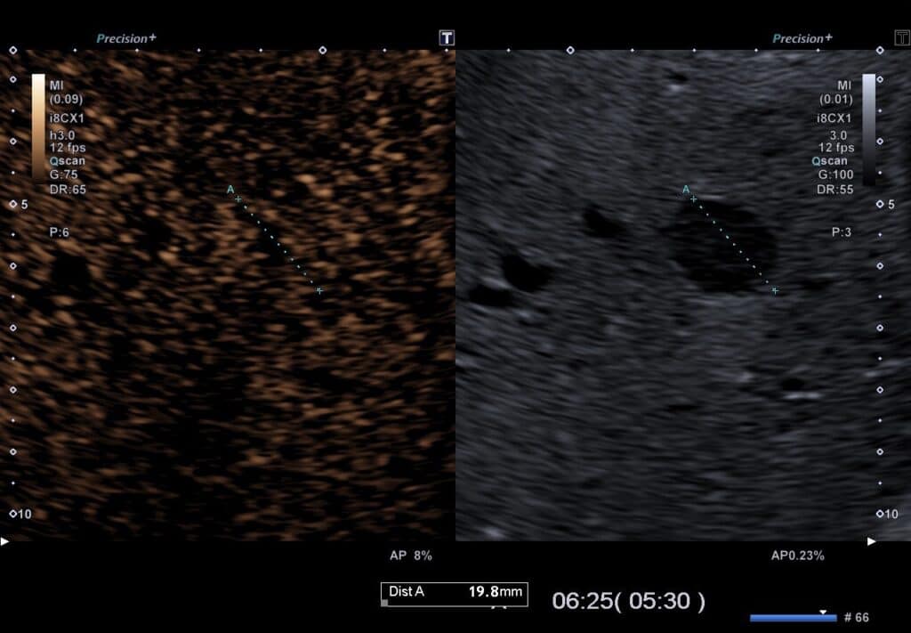 KM-Sonographie FNH