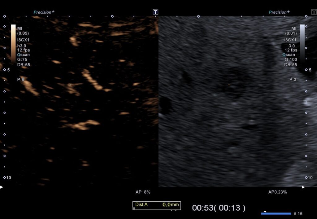 KM-Sonographie FNH