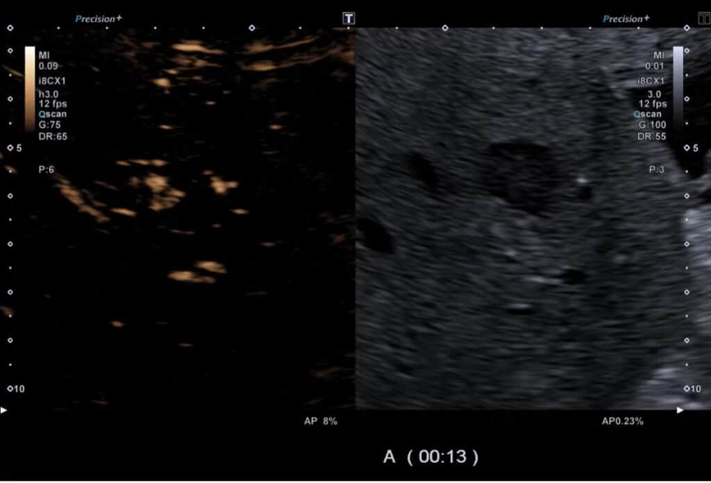 KM-Sonographie FNH